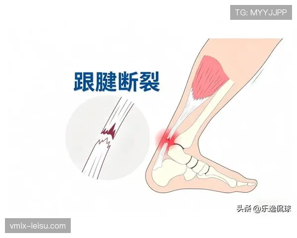 深度解析：埃基蒂克跟腱断裂重伤，或将无缘2026年世界杯